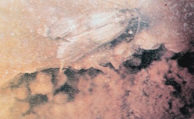 İncir üzerinde kuru meyve güvesi ergini